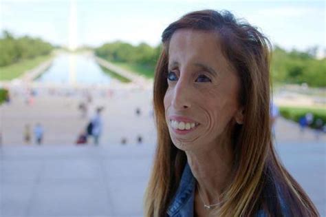 ugly whores|Teen Called Worlds Ugliest Woman, Now Grown Up, Starring in。